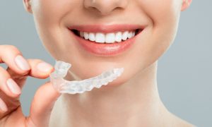 What Is Invisalign? Things You Need To Know